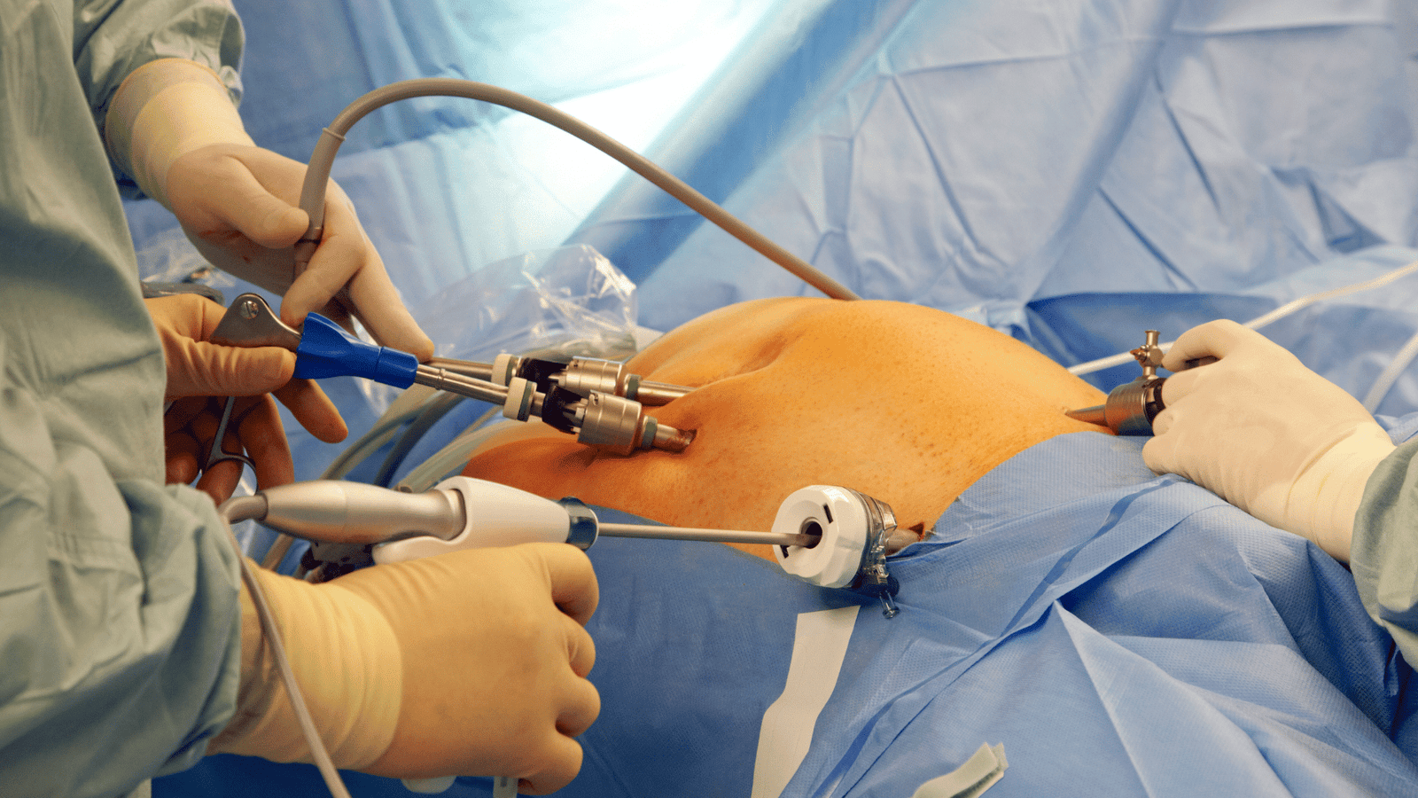 bariatric surgeon in south kolkata