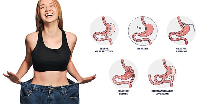 bariatric surgeon in south kolkata