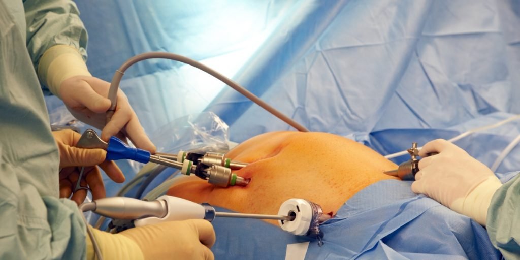 Laparoscopic Hernia Surgery in Kolkata
