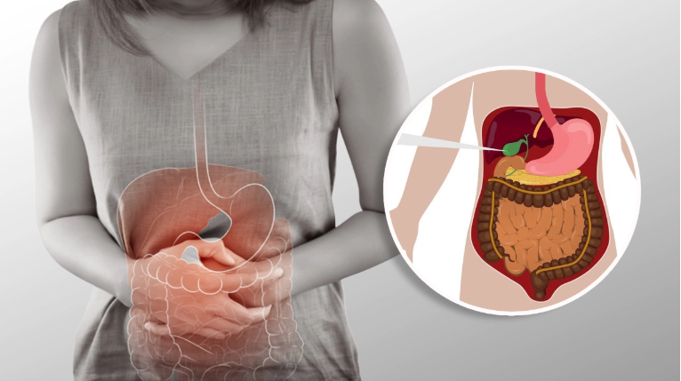 Best Gallbladder Surgeon in Kolkata