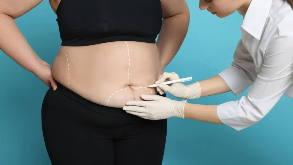 laparoscopic bariatric surgery in kolkata