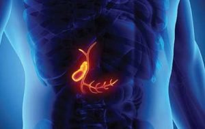 laparoscopic gallbladder surgeon in kolkata