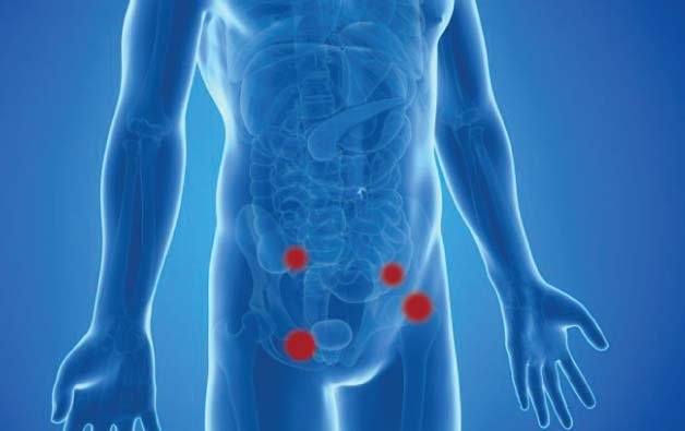 best laparoscopic surgeon in kolkata