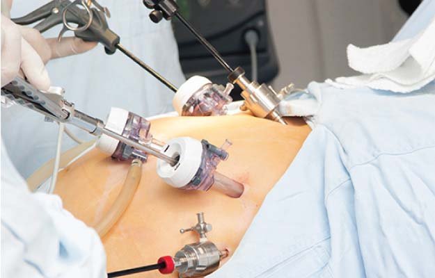 best laparoscopic surgeon in kolkata
