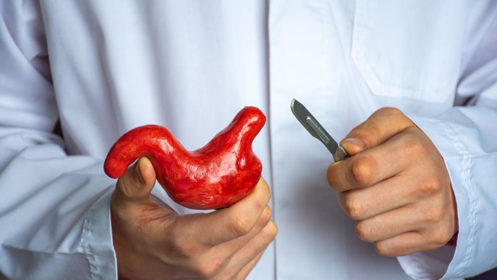 laparoscopic bariatric surgery in kolkata