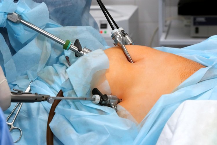 Laparoscopic hernia surgeon in kolkata